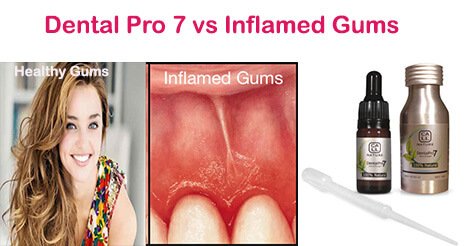 Dental Pro 7 vs Inflamed Gums